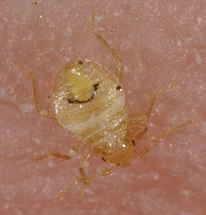 Bed Bug Photos | Bed Bug Fumigation Specialists